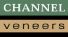 Channel Veeners